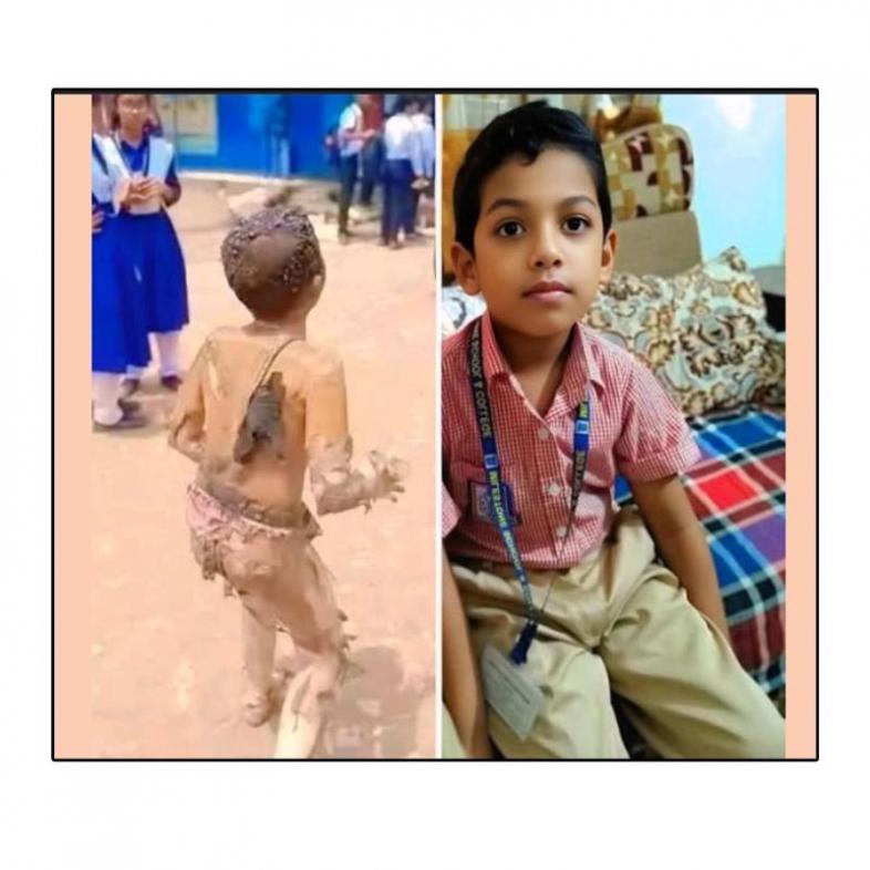 দহন