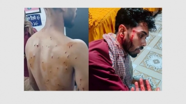 নোয়াখালীতে বিয়ে বাড়ীতে সন্ত্রাসী হায়লায় গুলিবিদ্ধ ৪